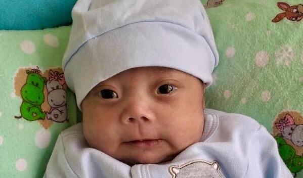 Photo of Thiago post-operation
