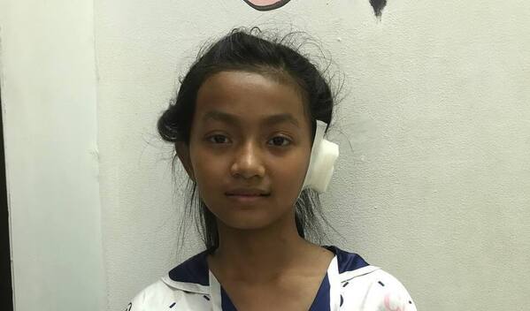 Channy Mathiseon Success! Channy from Cambodia raised $477 to fund ear surgery so she ...