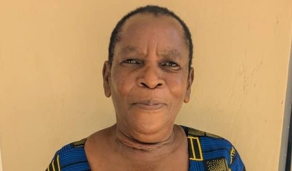 Success! Adija from Malawi raised $1,015 to fund a thyroidectomy. | Watsi