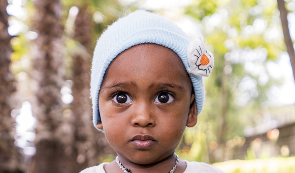Photo of Salim post-operation