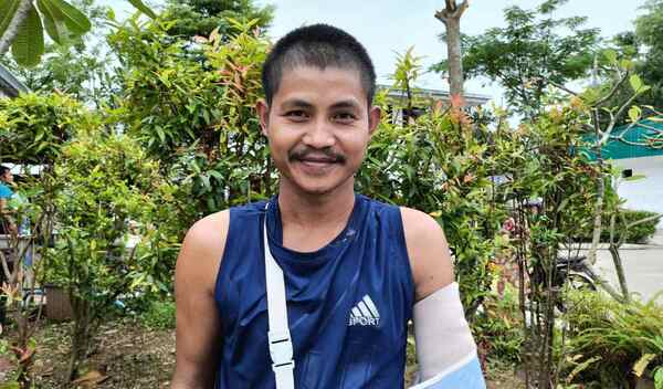 Photo of Htoo post-operation