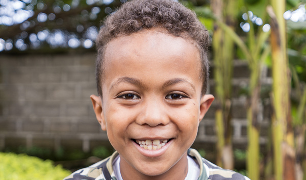 Photo of Bereket post-operation