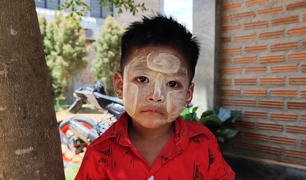 Photo of Thant post-operation