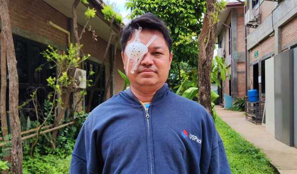 Photo of Thuta post-operation