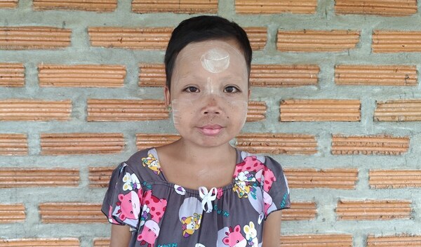 Photo of Poh post-operation
