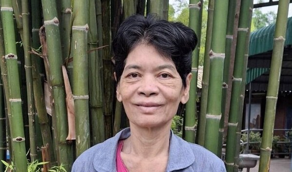 Photo of Myint post-operation