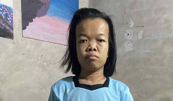 Photo of Prae post-operation