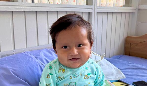 Photo of Roy post-operation