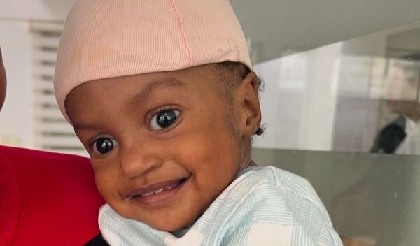 Photo of Berenice post-operation