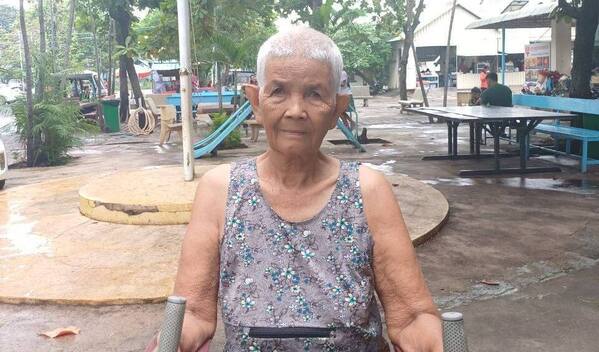 Photo of Phorn post-operation