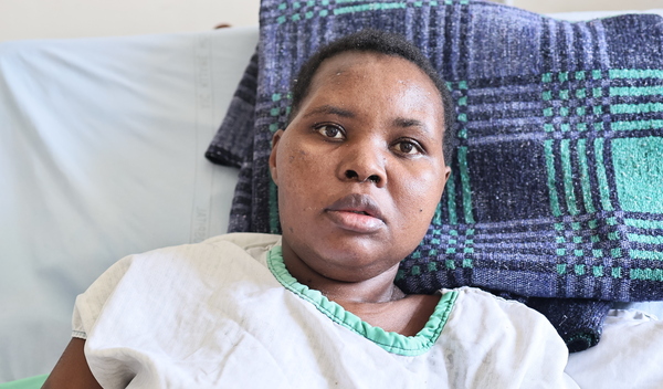 Photo of Catherine post-operation
