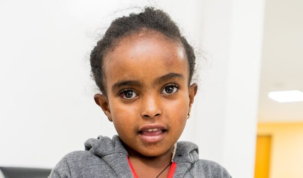 Photo of Selam post-operation