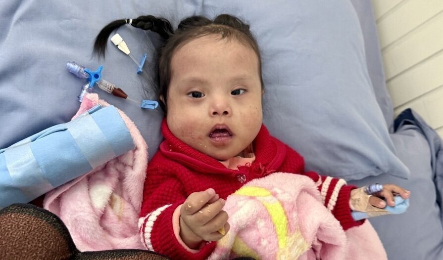 Photo of Valentina post-operation