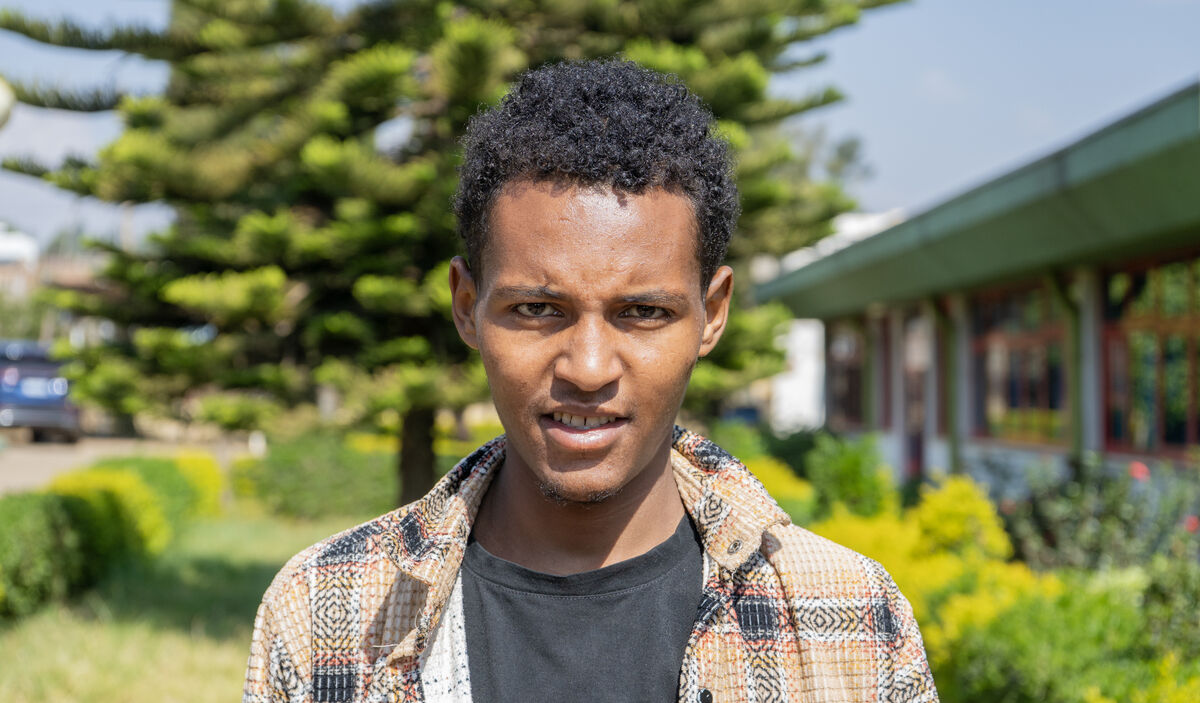 Photo of Lechisa post-operation
