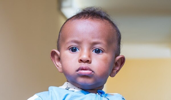 Photo of Kidus post-operation