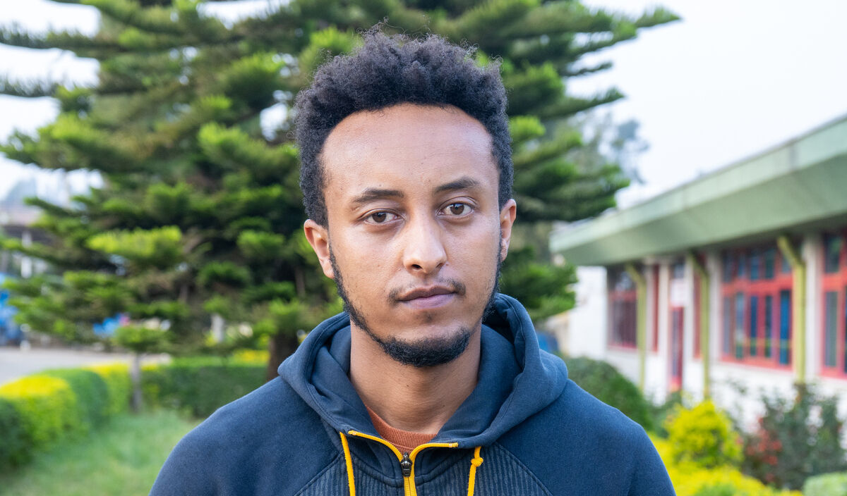 Photo of Efrem post-operation