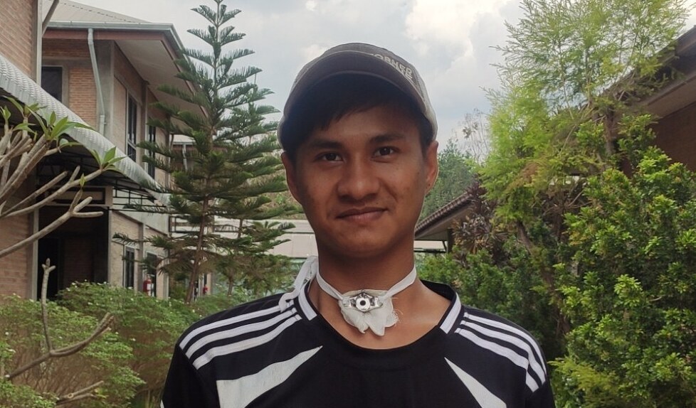 Photo of Nan Htet post-operation