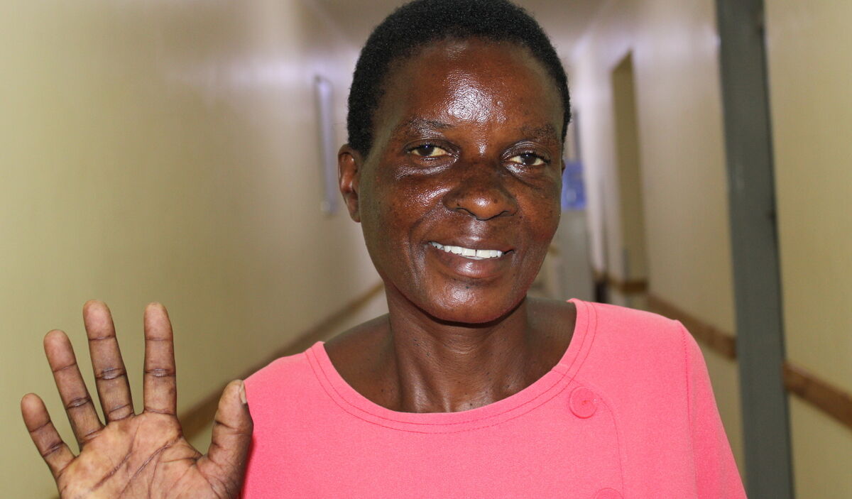 Photo of Grace post-operation