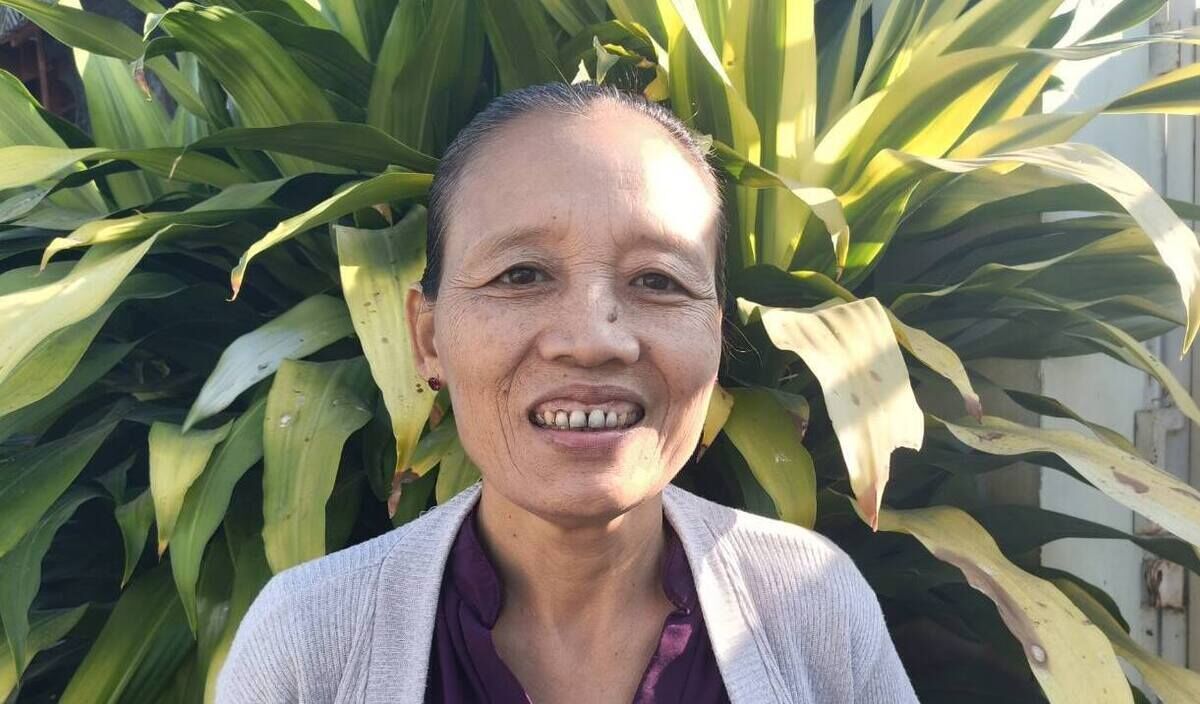Photo of Naw Paw post-operation