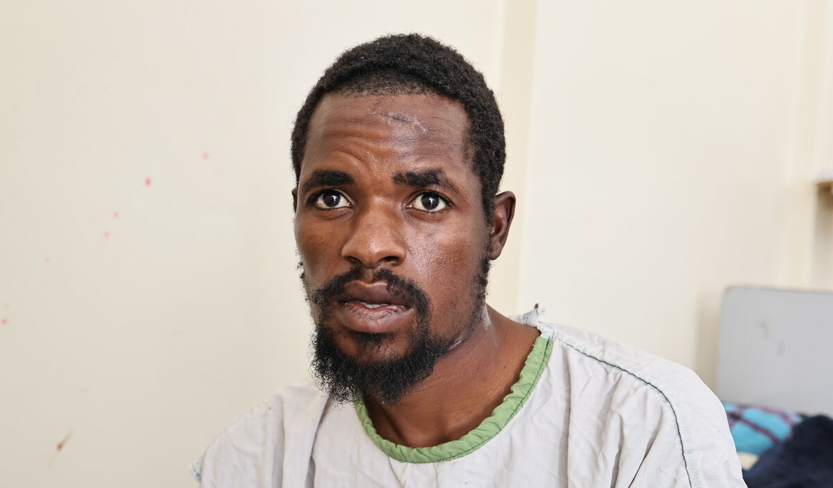 Photo of Moses post-operation
