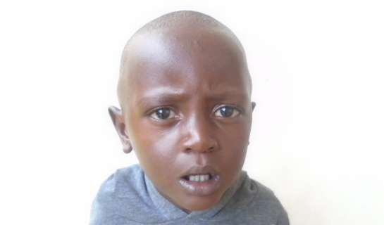 Photo of Tusiime post-operation