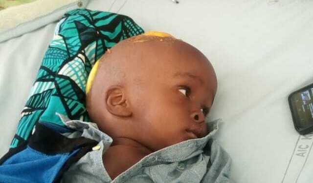 Photo of Zubeir post-operation
