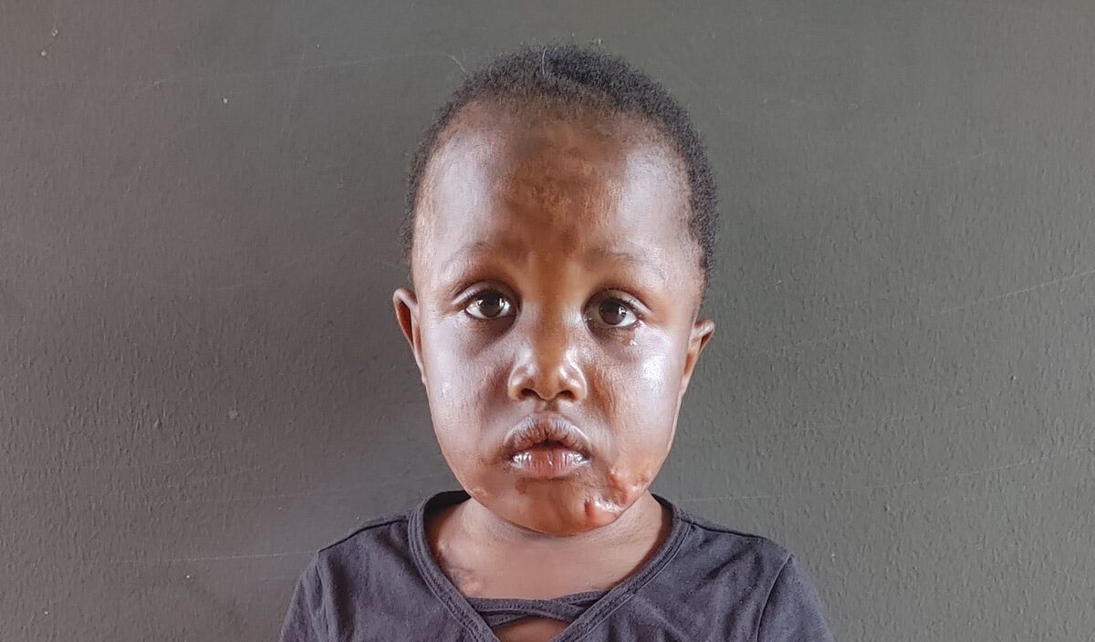 Photo of Gevan post-operation