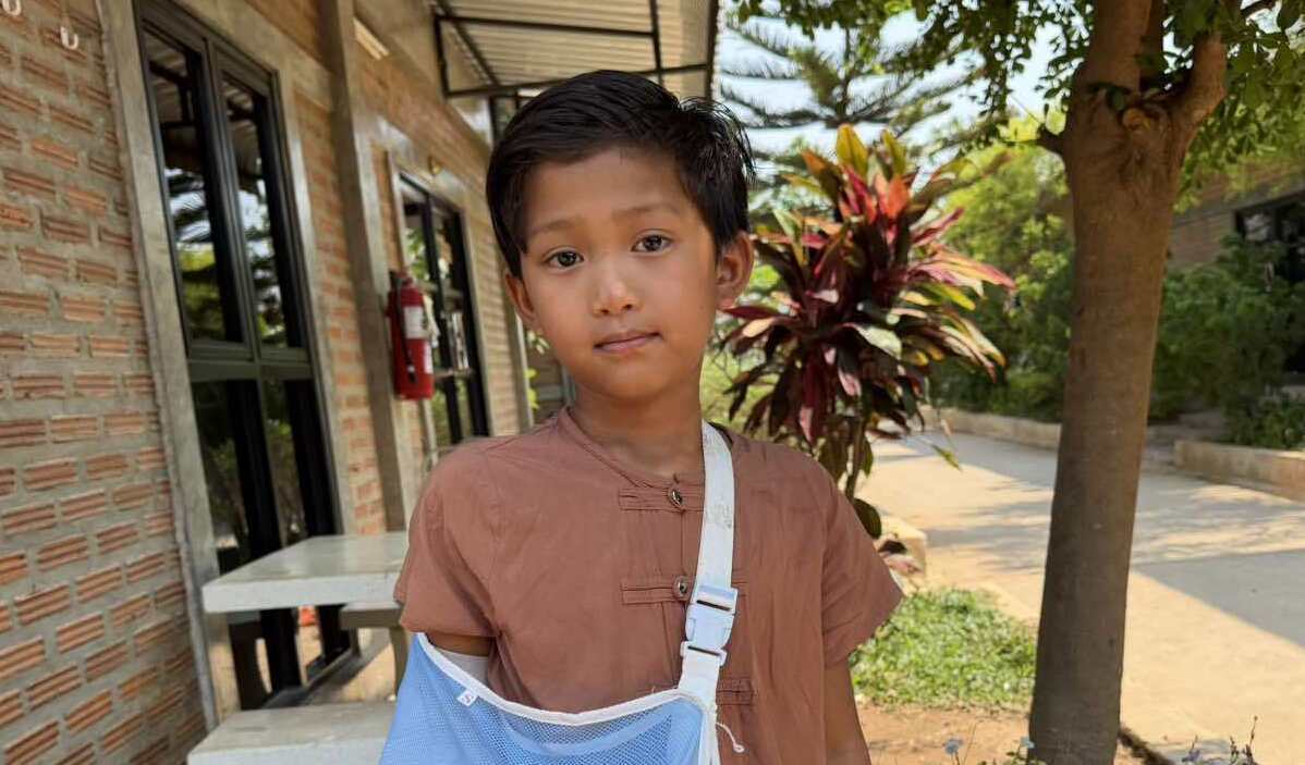 Photo of Kaung post-operation