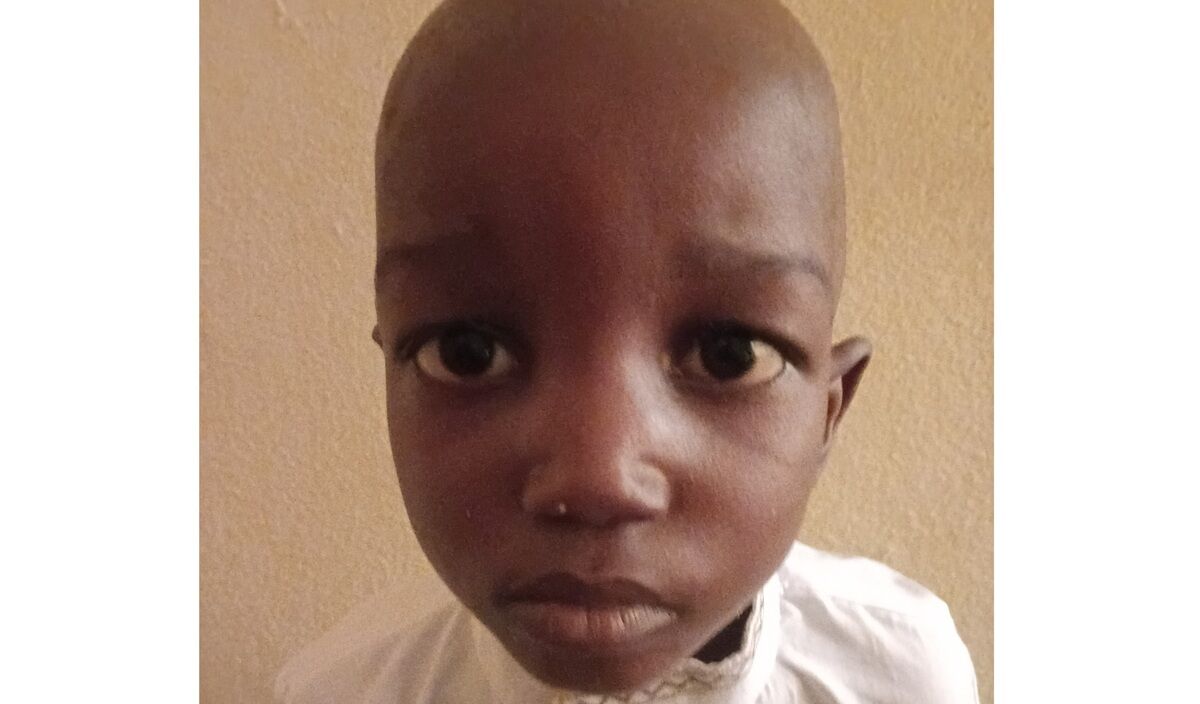 Photo of Baba post-operation