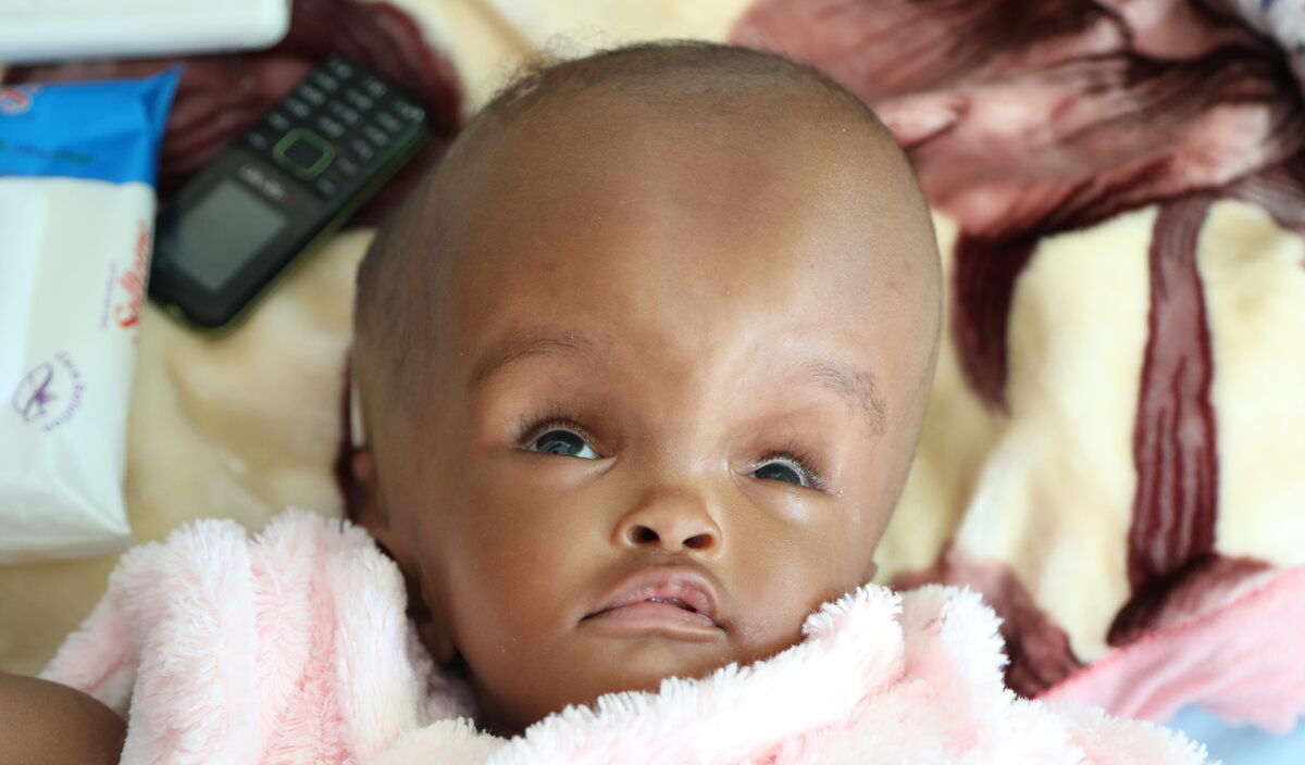 Photo of Edda post-operation