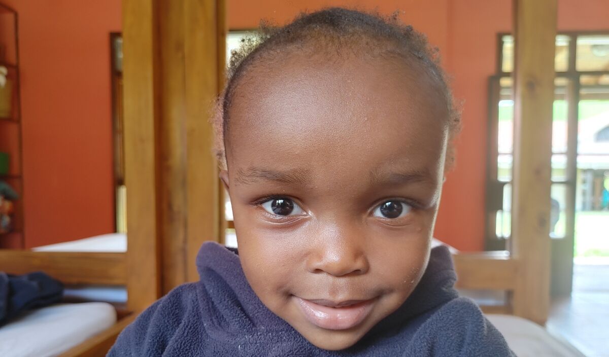 Photo of Nuruhaiya post-operation