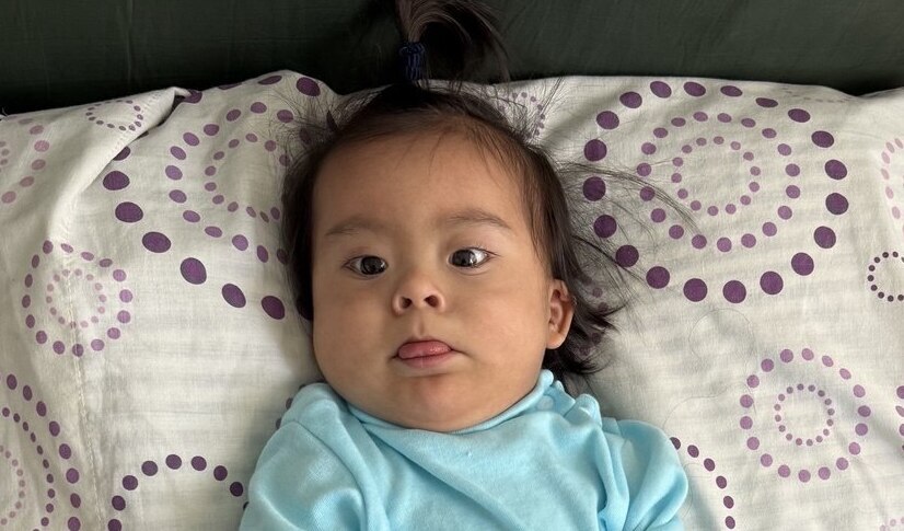 Photo of Matias post-operation