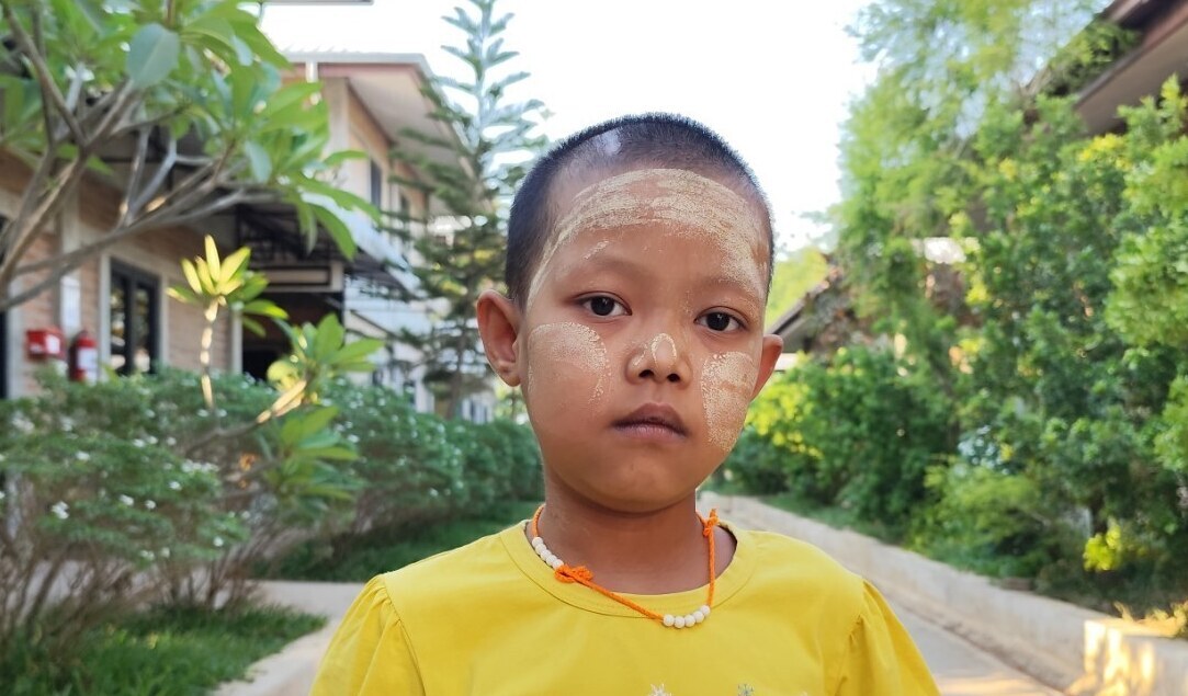 Photo of Su post-operation