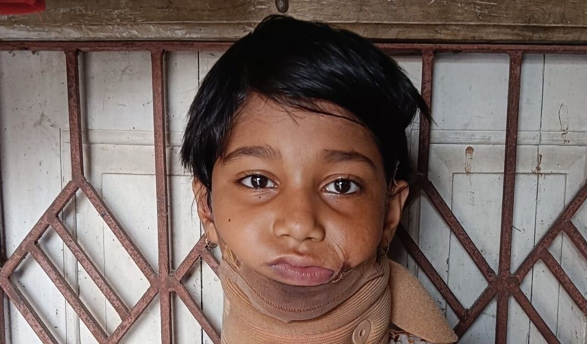 Photo of Nusrat post-operation