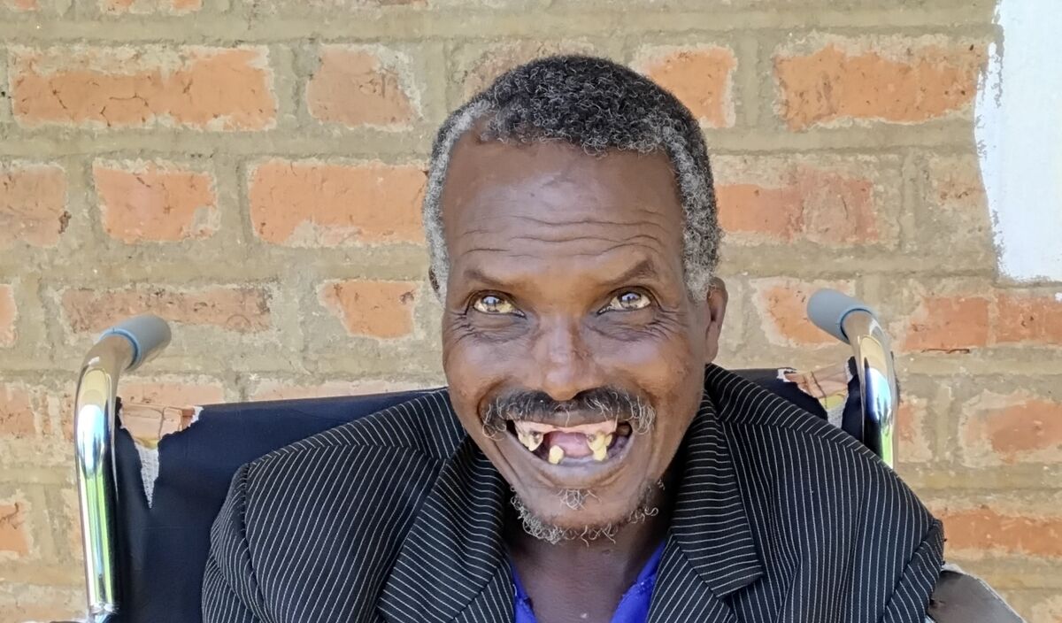 Photo of Musa post-operation