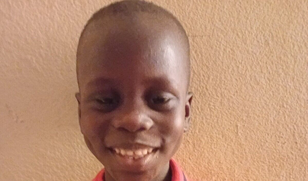 Photo of Dramane post-operation