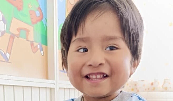 Photo of Mateo post-operation