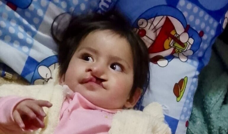 Photo of Ana post-operation