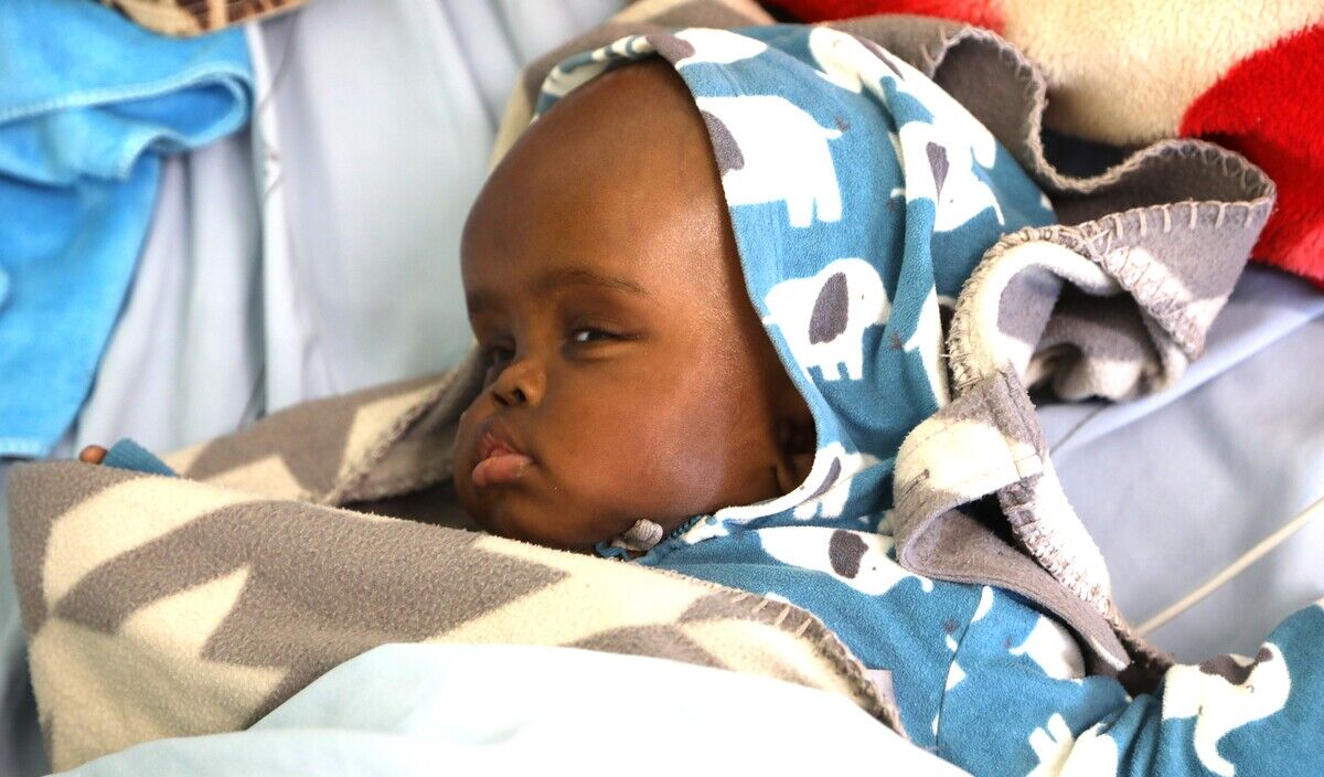 Photo of Amanda post-operation