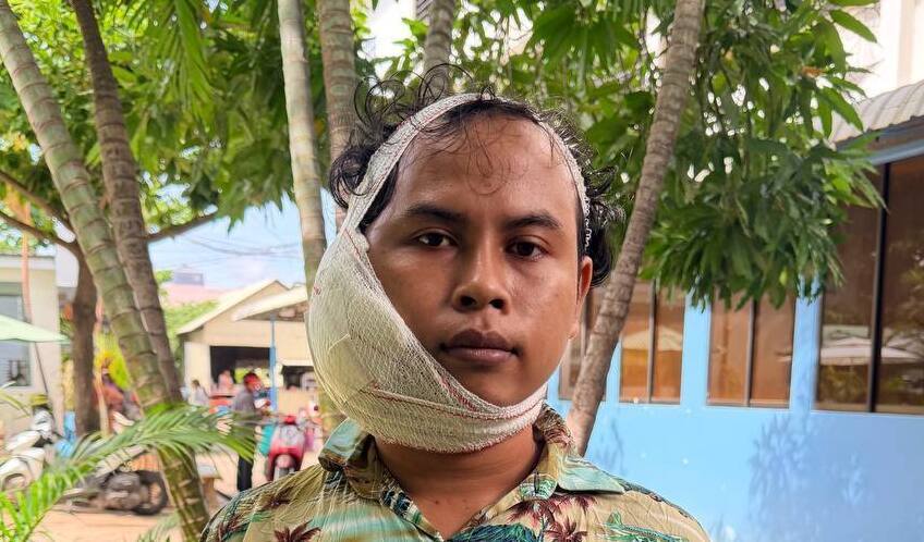 Photo of Sopy post-operation