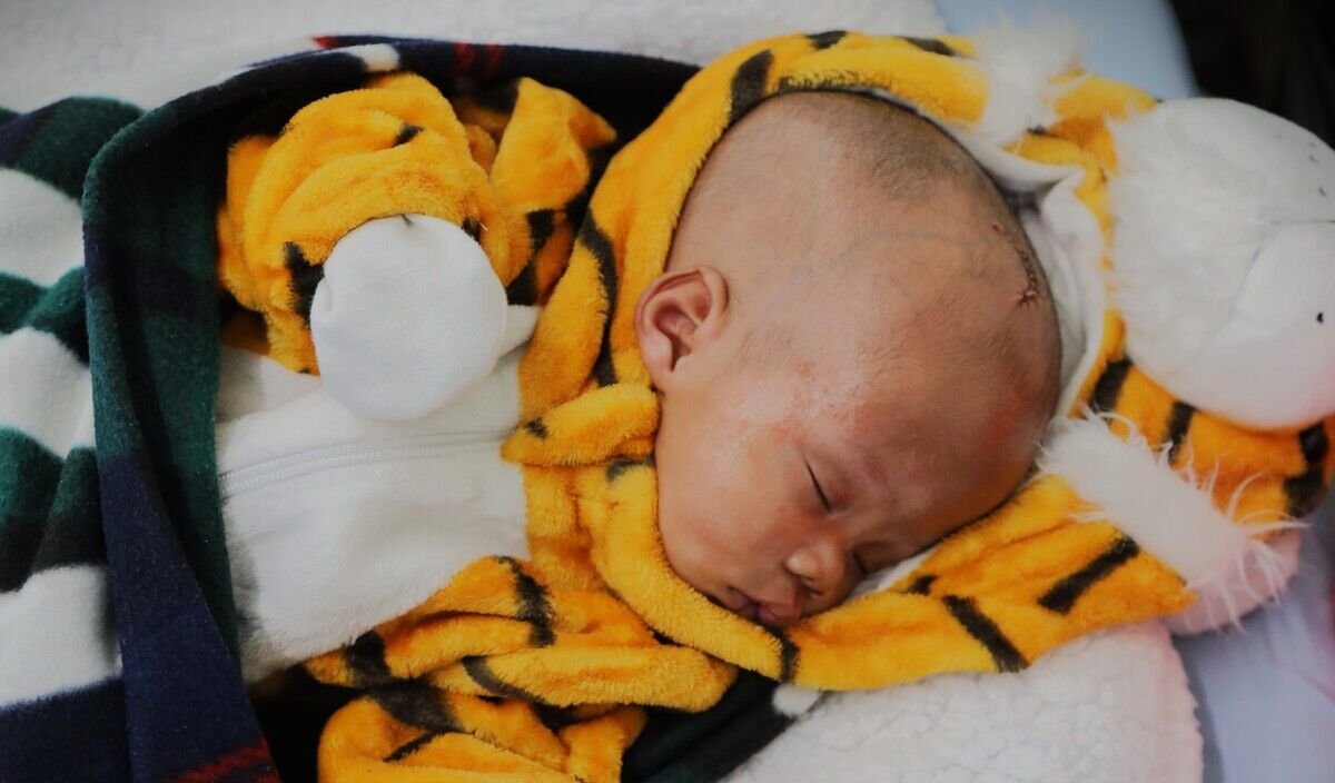 Photo of Ethan post-operation