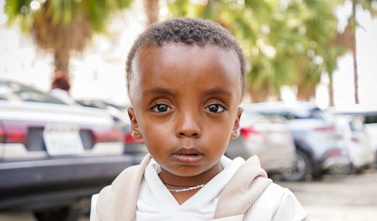 Photo of Kidus post-operation