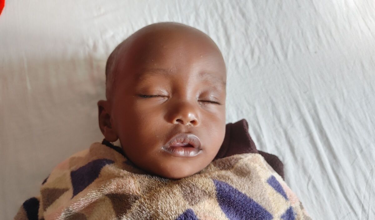Photo of Esuphat post-operation