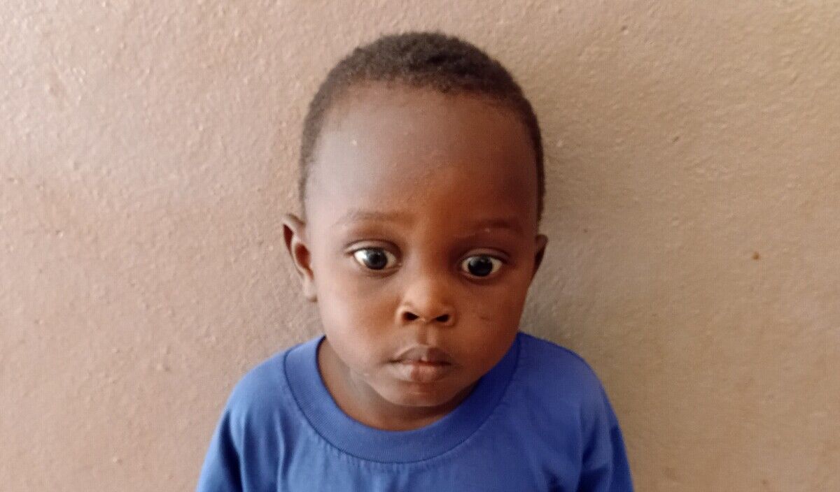 Photo of Adama post-operation