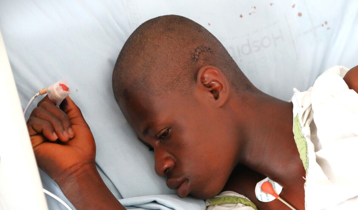 Photo of Juma post-operation