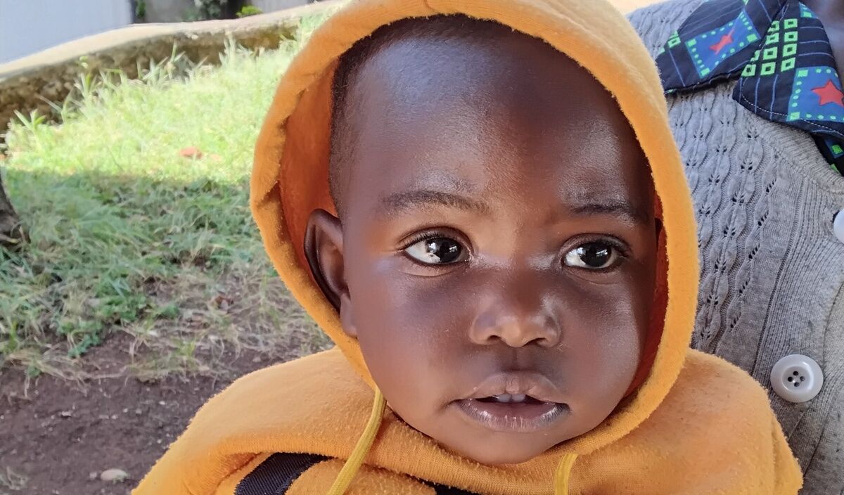 Photo of Jenifer post-operation