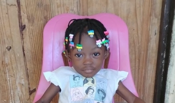 Photo of Deborah post-operation