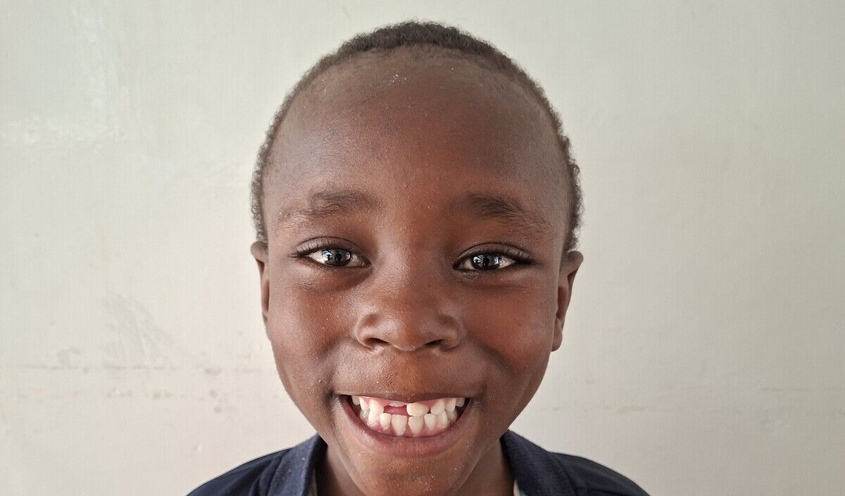 Photo of Chillion post-operation