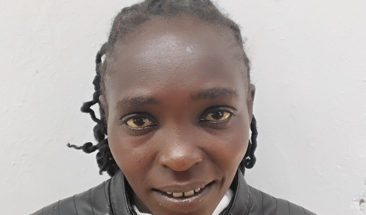 Photo of Vivian post-operation