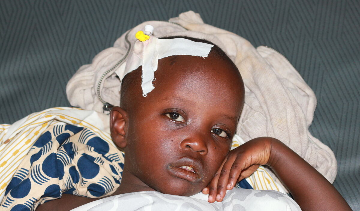 Photo of Athia post-operation